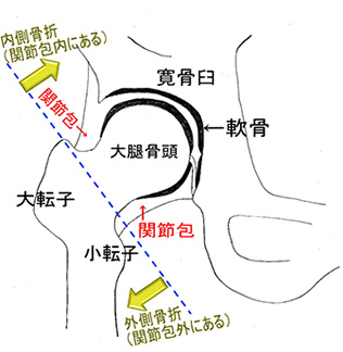 正常な膝関節イメージ