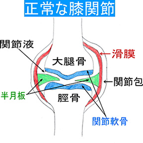 正常な膝関節イメージ